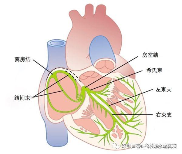 心脏起搏器基础教程_临床实用心脏起搏技术_心脏起搏器操作步骤